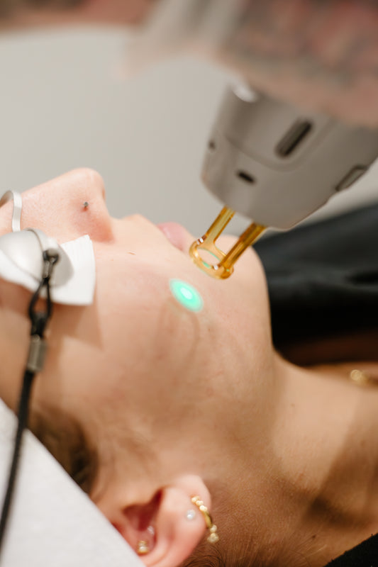 ProGenesis Laser Treatment