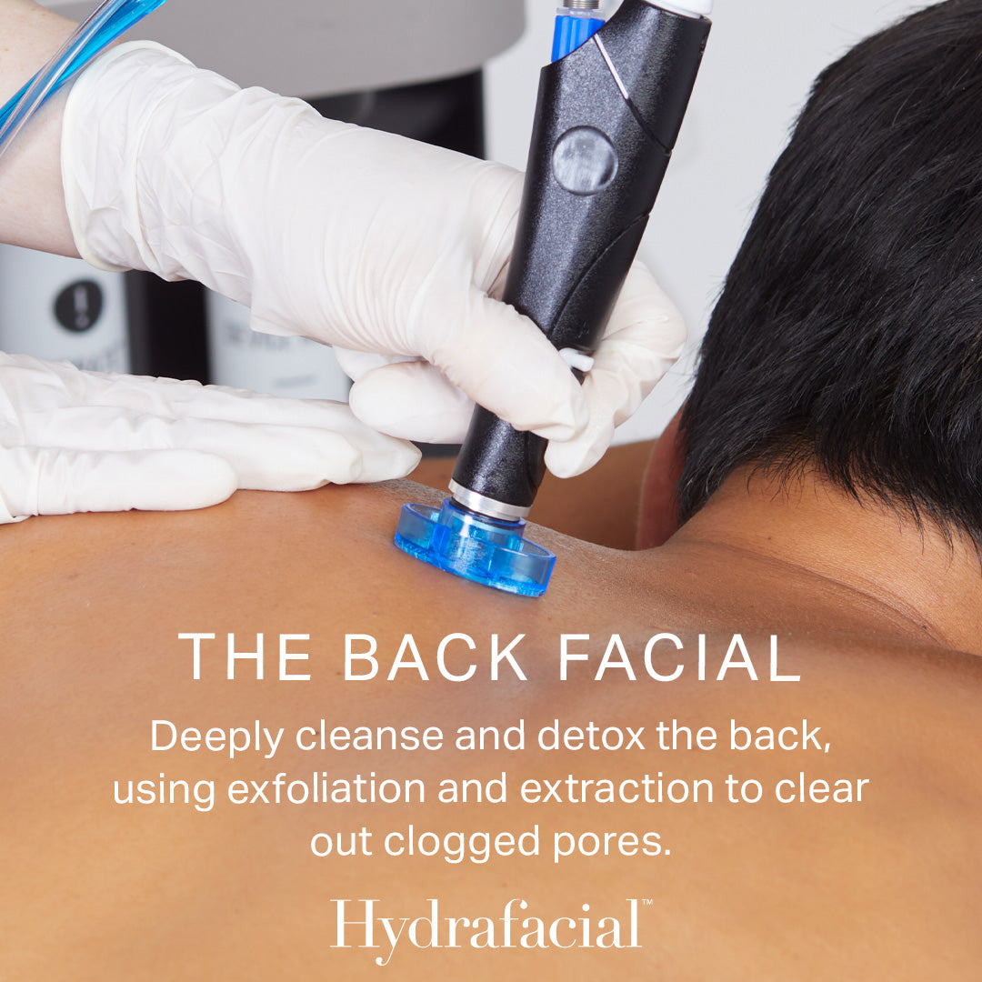 HydraBody