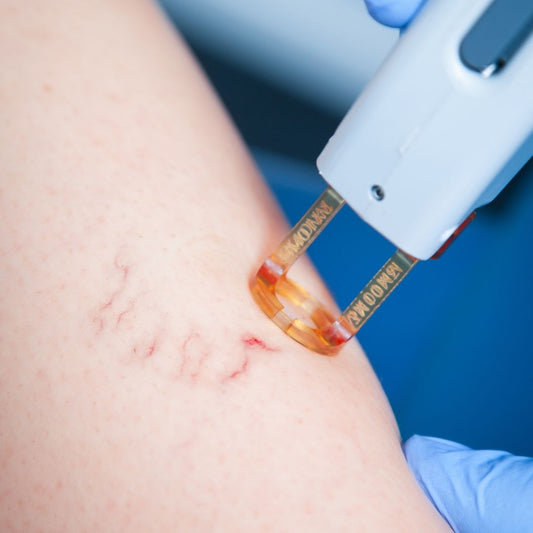 Vascular Laser