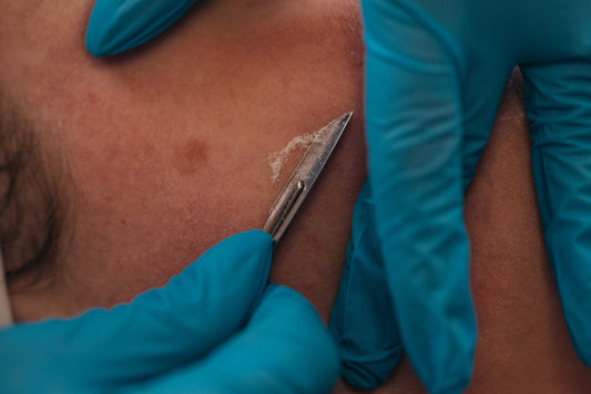 Dermaplaning
