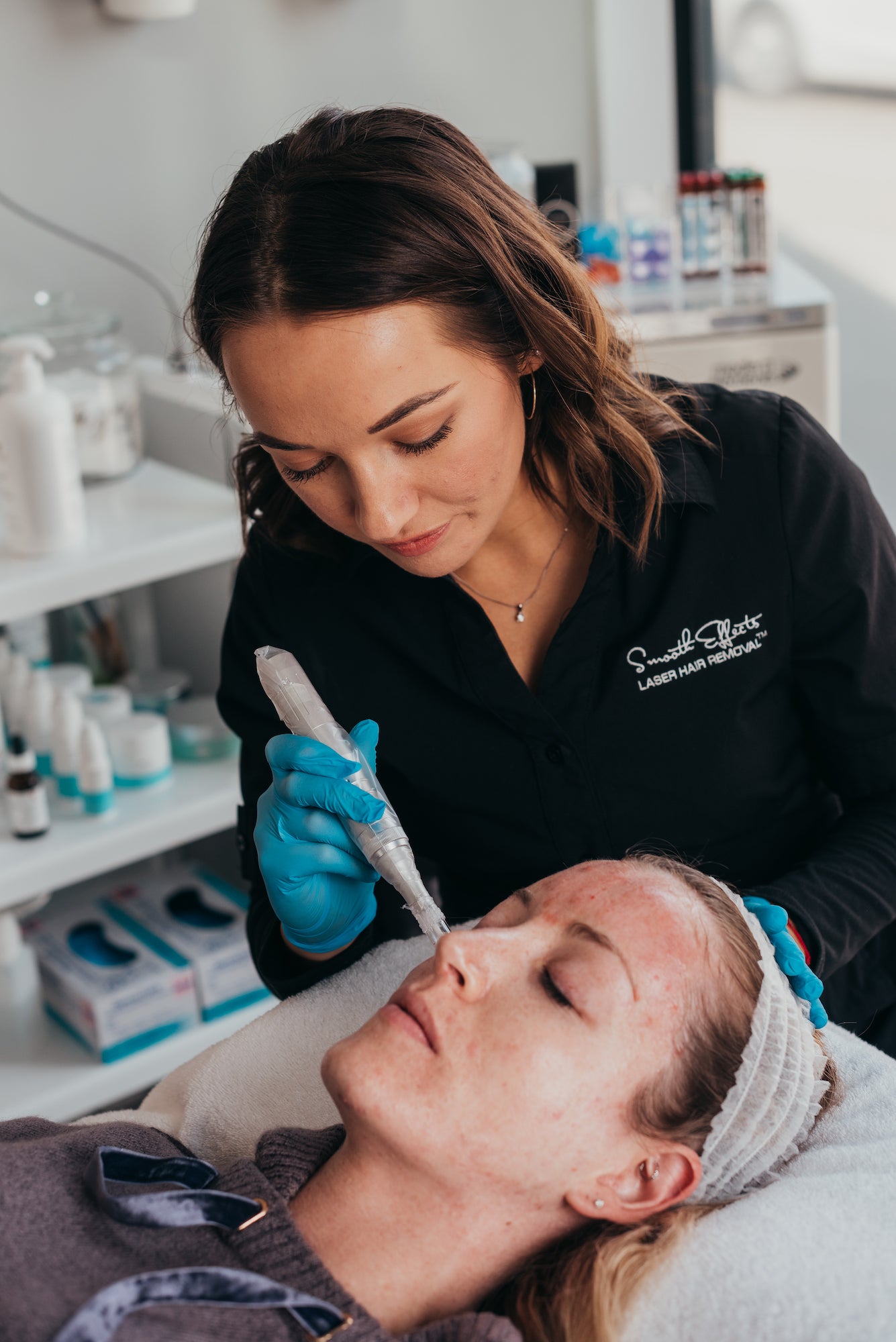 Microneedling - Face